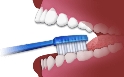 Brushing illustration