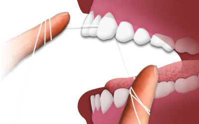 Flossing illustration